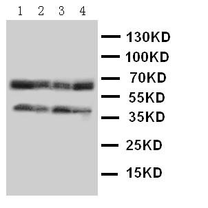 Anti-CCR5 Polyclonal Antibody