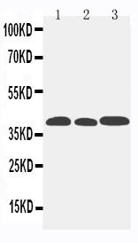 Anti-CCR5 Polyclonal Antibody