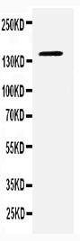 Polyclonal Antibody to Anti-CD22 Antibody(Discontinued)