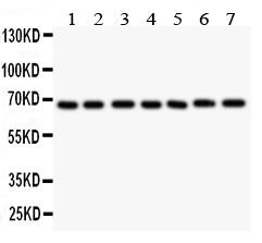 Anti-GAD67 Polyclonal Antibody