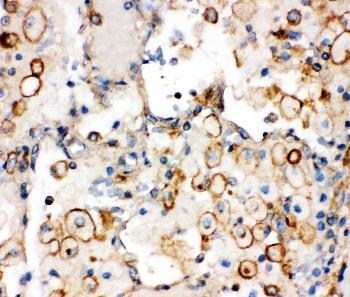 Anti-Integrin alpha 1 Polyclonal Antibody