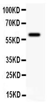 Anti-KCA3.1 Polyclonal Antibody