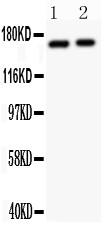 Anti-NMDAR2A Polyclonal Antibody