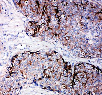 Anti-TIMP2 Polyclonal Antibody