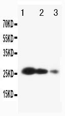 Anti-TIMP3 Polyclonal Antibody