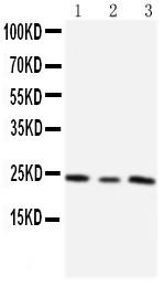 Anti-TIMP4 Polyclonal Antibody