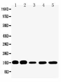 Anti-FABP1 Polyclonal Antibody