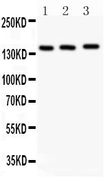 Polyclonal Antibody to Anti-APAF1 Antibody(Discontinued)