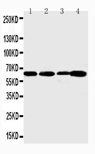 Polyclonal Antibody to Anti-Angiopoietin 1 Antibody(Discontinued)