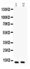 Anti-Eotaxin Polyclonal Antibody(Discontinued)