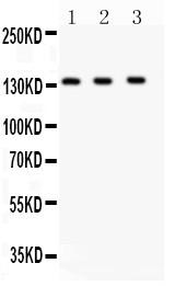 Polyclonal Antibody to Anti-JAK1 Antibody(Discontinued)