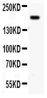 Anti-Integrin beta 4 Polyclonal Antibody(Discontinued)