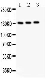 Polyclonal Antibody to Anti-eNOS Antibody(Discontinued)