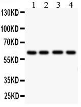 Anti-HEXA Polyclonal Antibody