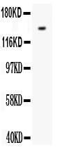 Anti-VEGF Receptor 1 Polyclonal Antibody