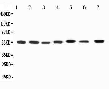 Anti-Kv1.1 potassium channel Polyclonal Antibody