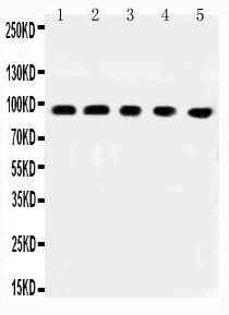 Polyclonal Antibody to Anti-MCC Antibody(Discontinued)