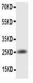 Anti-IL6 Polyclonal Antibody