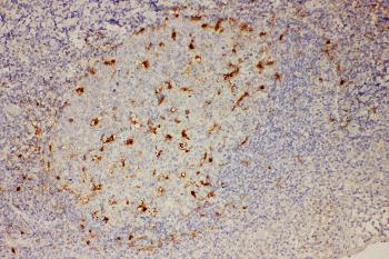 Anti-IL18 Polyclonal Antibody