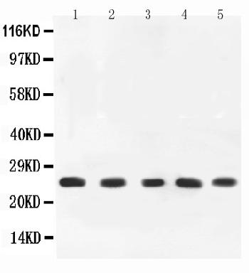 Anti-TNF alpha Polyclonal Antibody