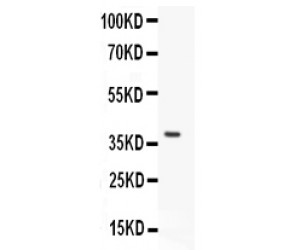 Polyclonal Antibody to VWF