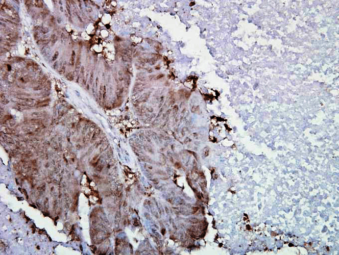 Anti-HSP90 alpha Monoclonal Antibody (Clone : Hyb-K41009) - FITC