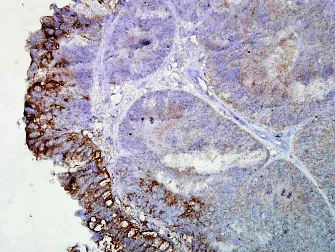 Anti-HSP90 Monoclonal Antibody (Clone : AC-16)