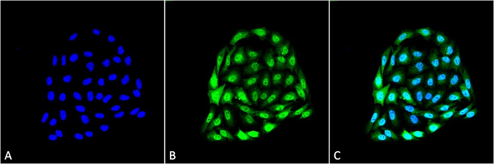 Anti-HSP70 Monoclonal Antibody (Clone : 1.86)(Discontinued)