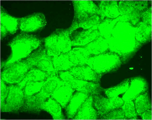 Anti-HSP40, Hdj1 Monoclonal Antibody (Clone : 3B9.E6)