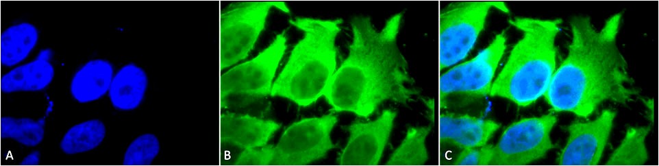 Anti-HSC70 (HSP73) Monoclonal Antibody (Clone : 1F2-H5)