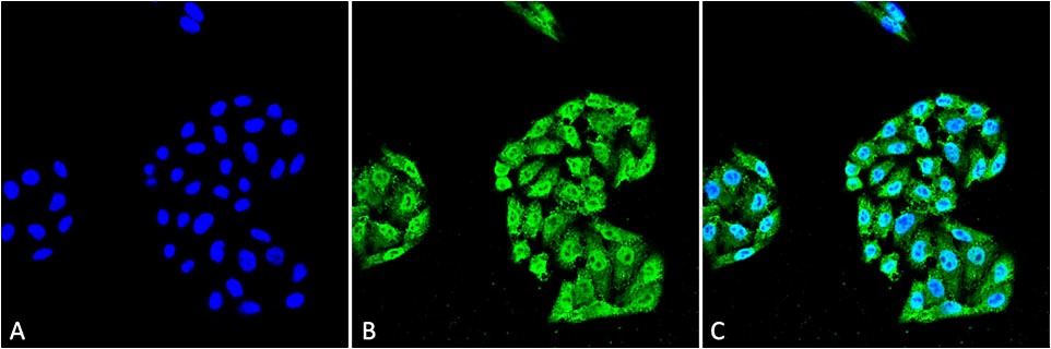 Anti-HSP70 Monoclonal Antibody (Clone : 5A5)