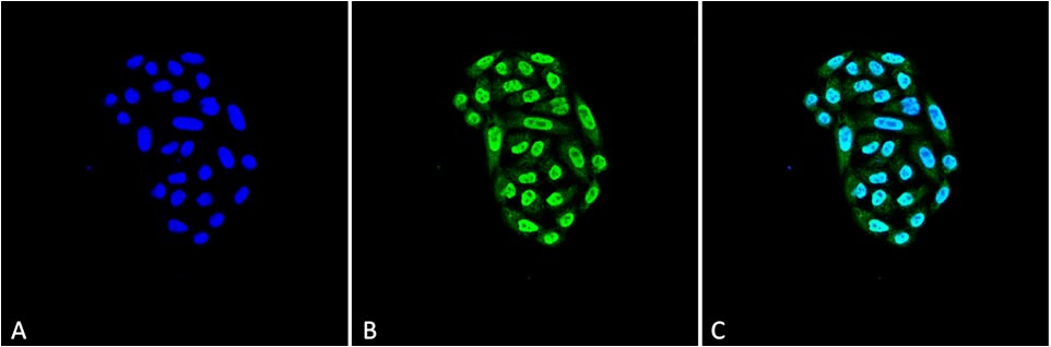 Anti-HSP70 Monoclonal Antibody (Clone : 2A4)(Discontinued)