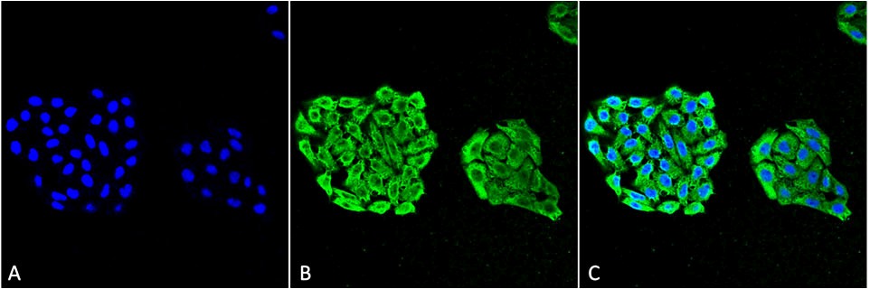 Anti-HSP70 Monoclonal Antibody (Clone : 3A3)