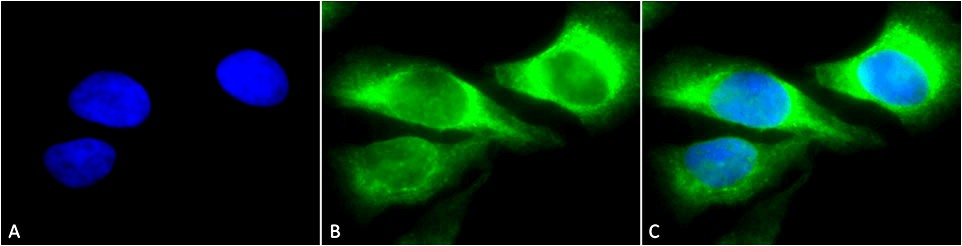 Anti-HSP47 Monoclonal Antibody (Clone : 1C4-1A6) - Streptavidin(Discontinued)