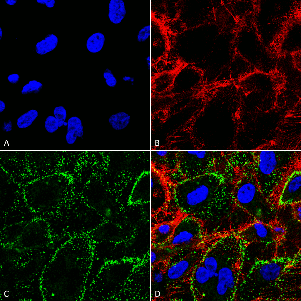 Anti-HSP70 Monoclonal Antibody (Clone : 1H11) - FITC