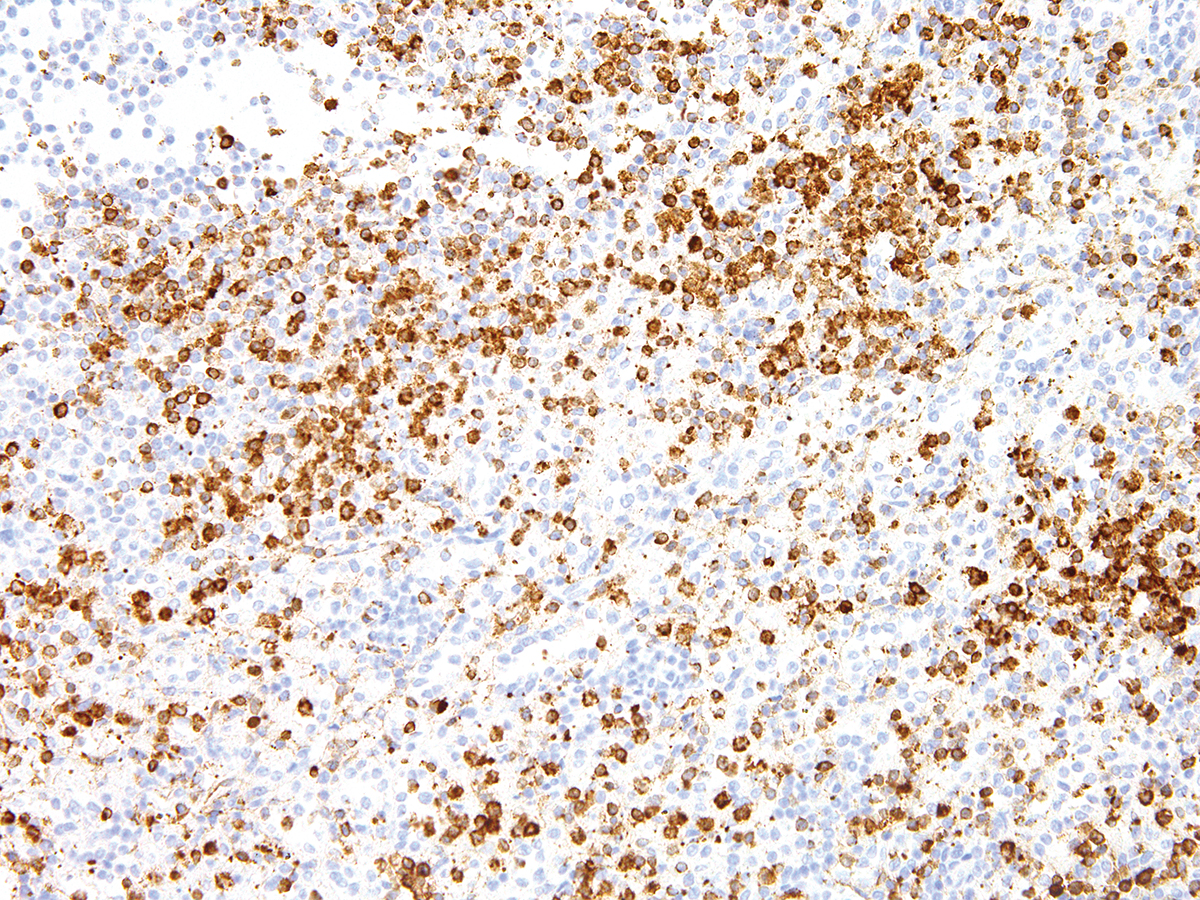 Anti-Annexin A1 Monoclonal Antibody (Clone:IHC512)