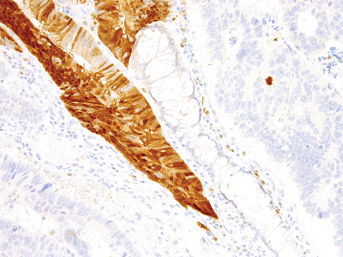 Anti-Arginase-1 Monoclonal Antibody (Clone:IHC400)(Discontinued)