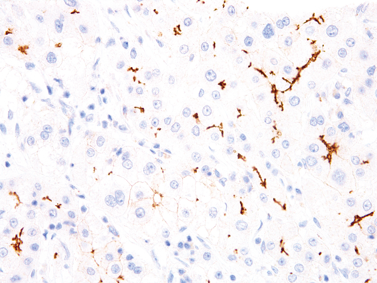 Anti-BSEP Monoclonal Antibody (Clone:IHC518)-Ready to Use