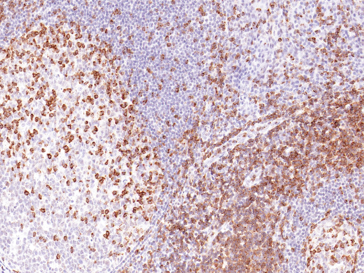 Anti-CD2 Monoclonal Antibody (Clone:IHC531)(Discontinued)