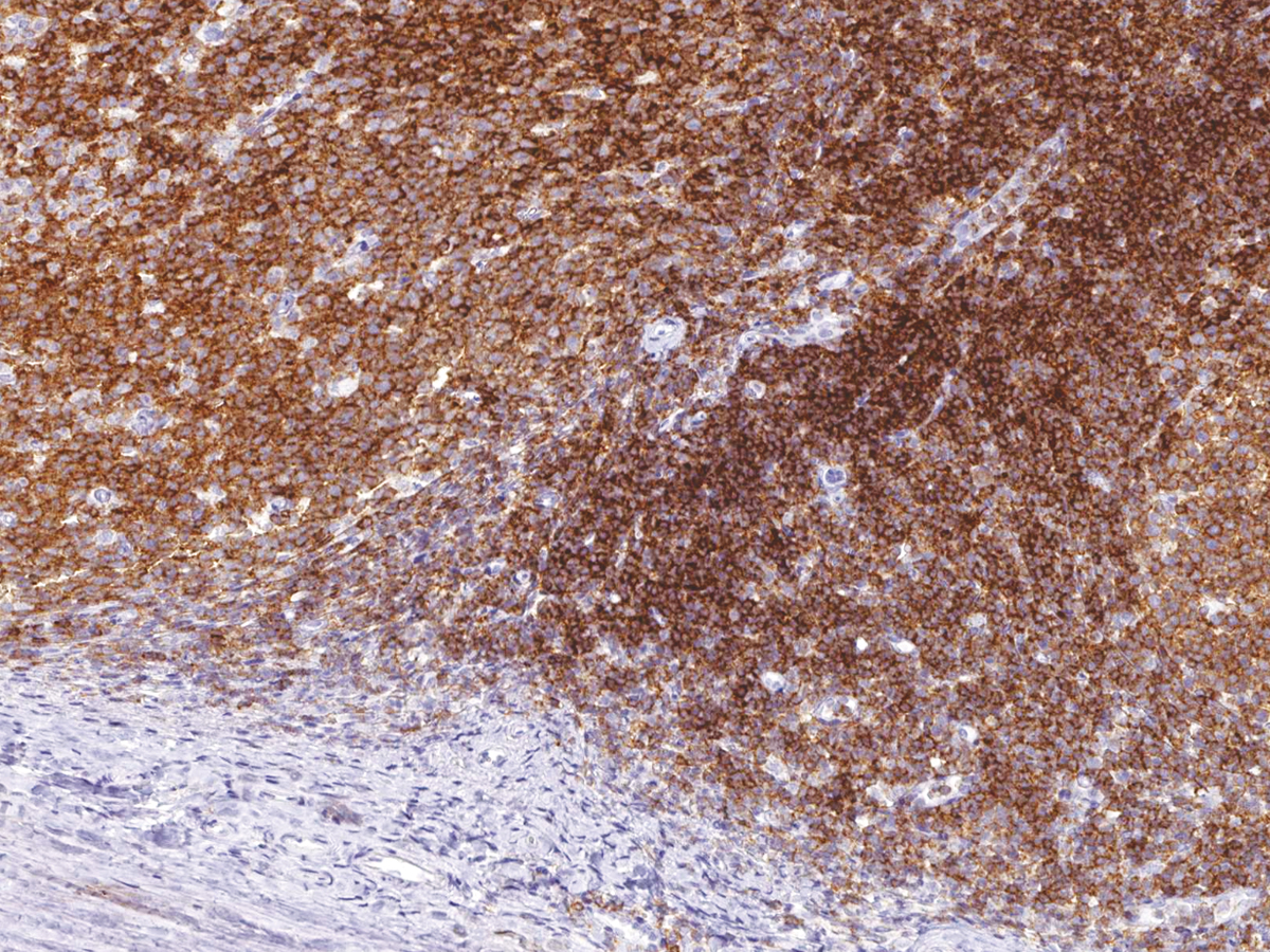 Anti-CD45 (LCA) Monoclonal Antibody (Clone:IHC045)-Ready to Use(Discontinued)