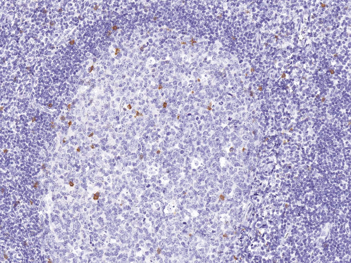 Anti-CD57 Monoclonal Antibody (Clone:IHC539)-Ready to Use