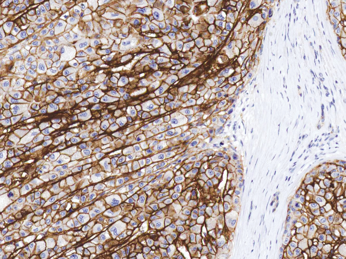 Anti-CD138 Monoclonal Antibody (Clone:IHC138)