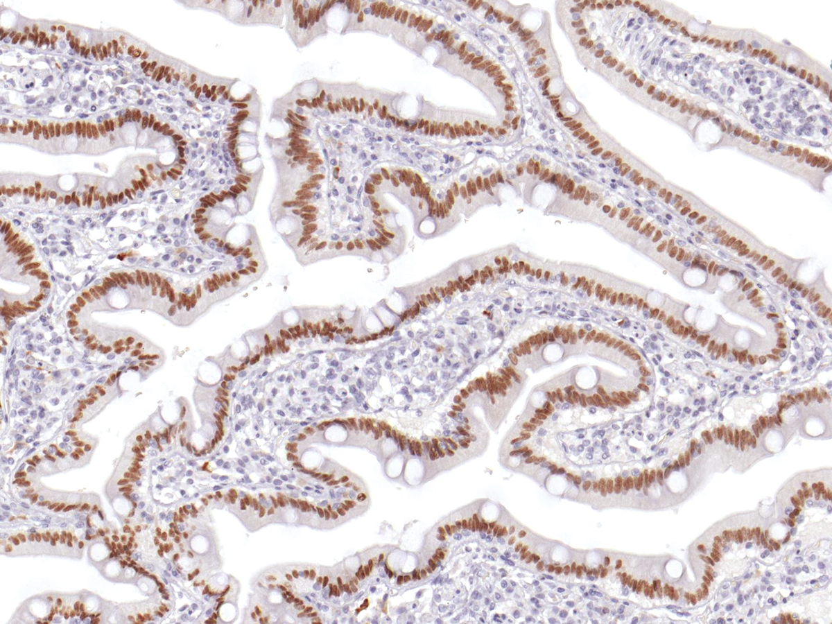 Anti-CDX-2 Monoclonal Antibody (Clone:IHC402)(Discontinued)