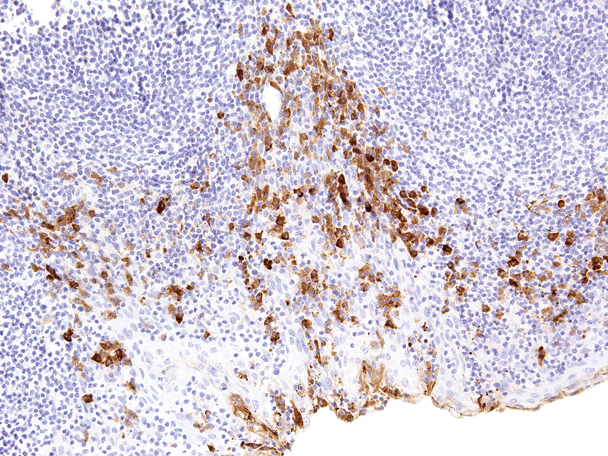 Anti-CTLA-4 Monoclonal Antibody (Clone:IHC004)(Discontinued)