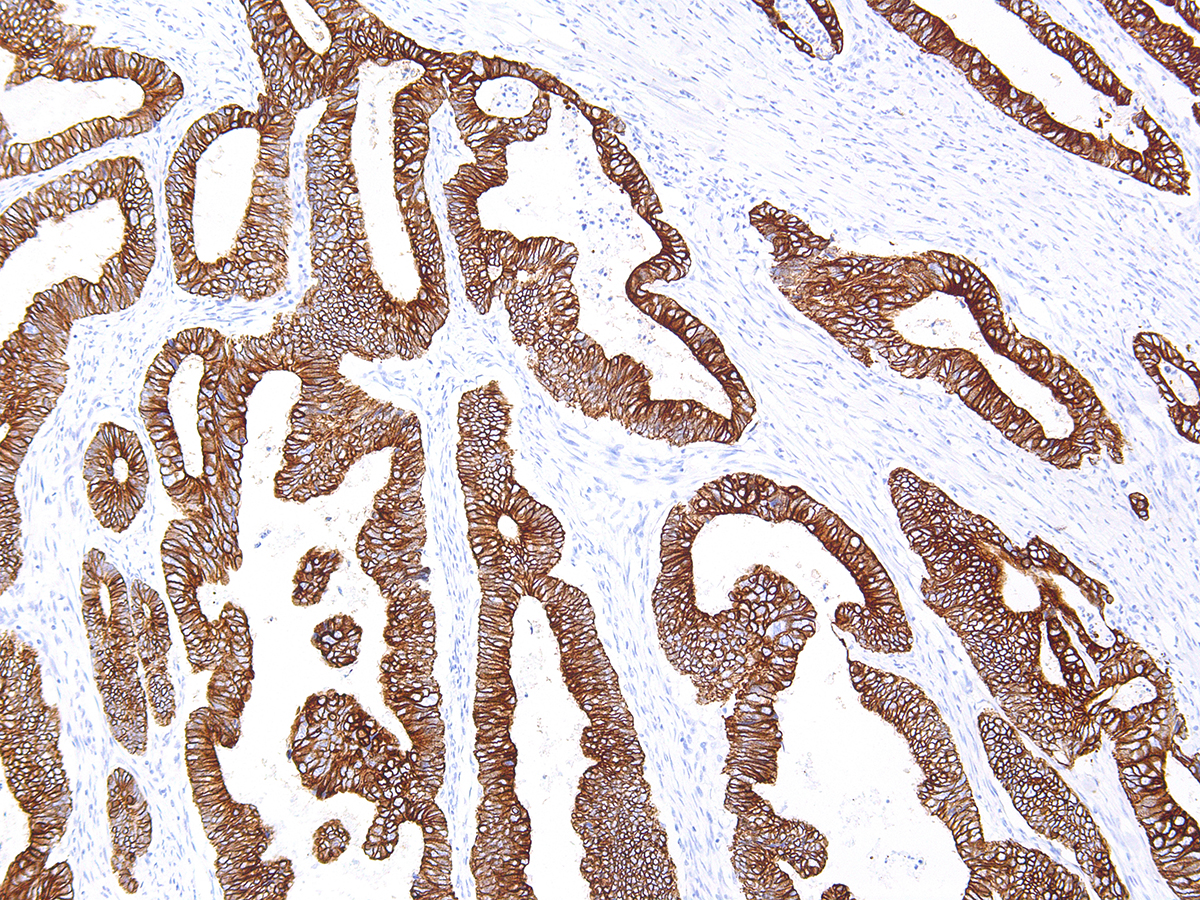 Anti-Cytokeratin 18 Monoclonal Antibody (Clone:IHC018)