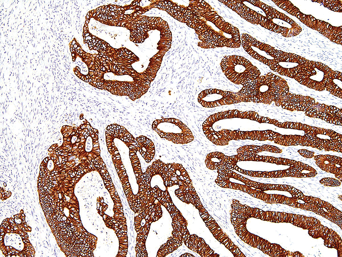 Anti-Cytokeratin 19 Monoclonal Antibody (Clone:IHC019)