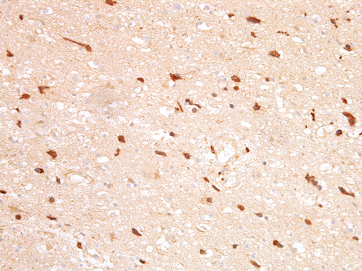 Anti-IDH1 R132H Monoclonal Antibody (Clone:IHC132)