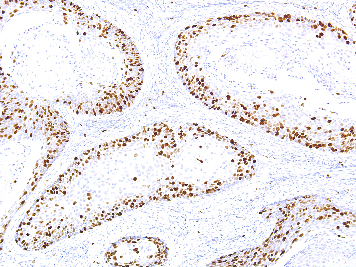 Anti-Ki-67 Monoclonal Antibody (Clone:IHC067)