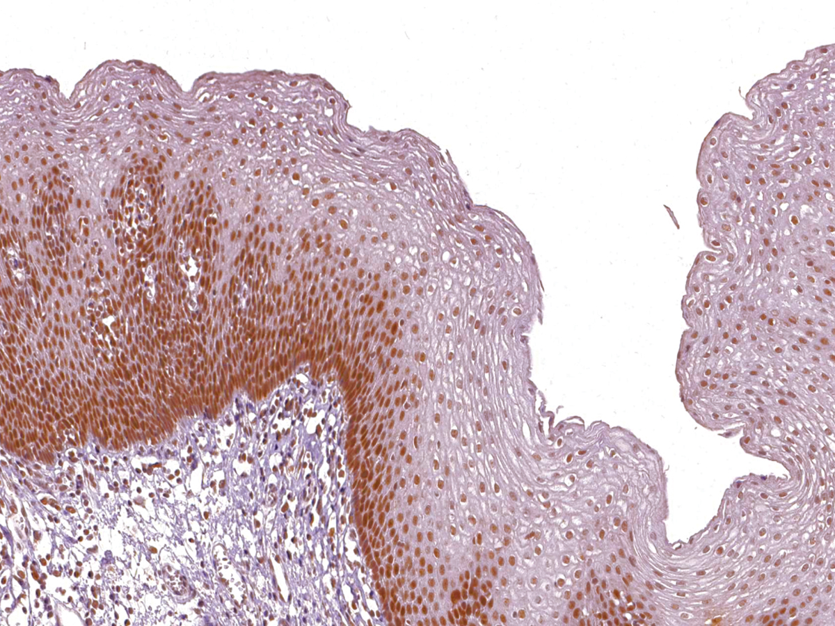 Anti-MSH2 Monoclonal Antibody (Clone:IHC410)(Discontinued)