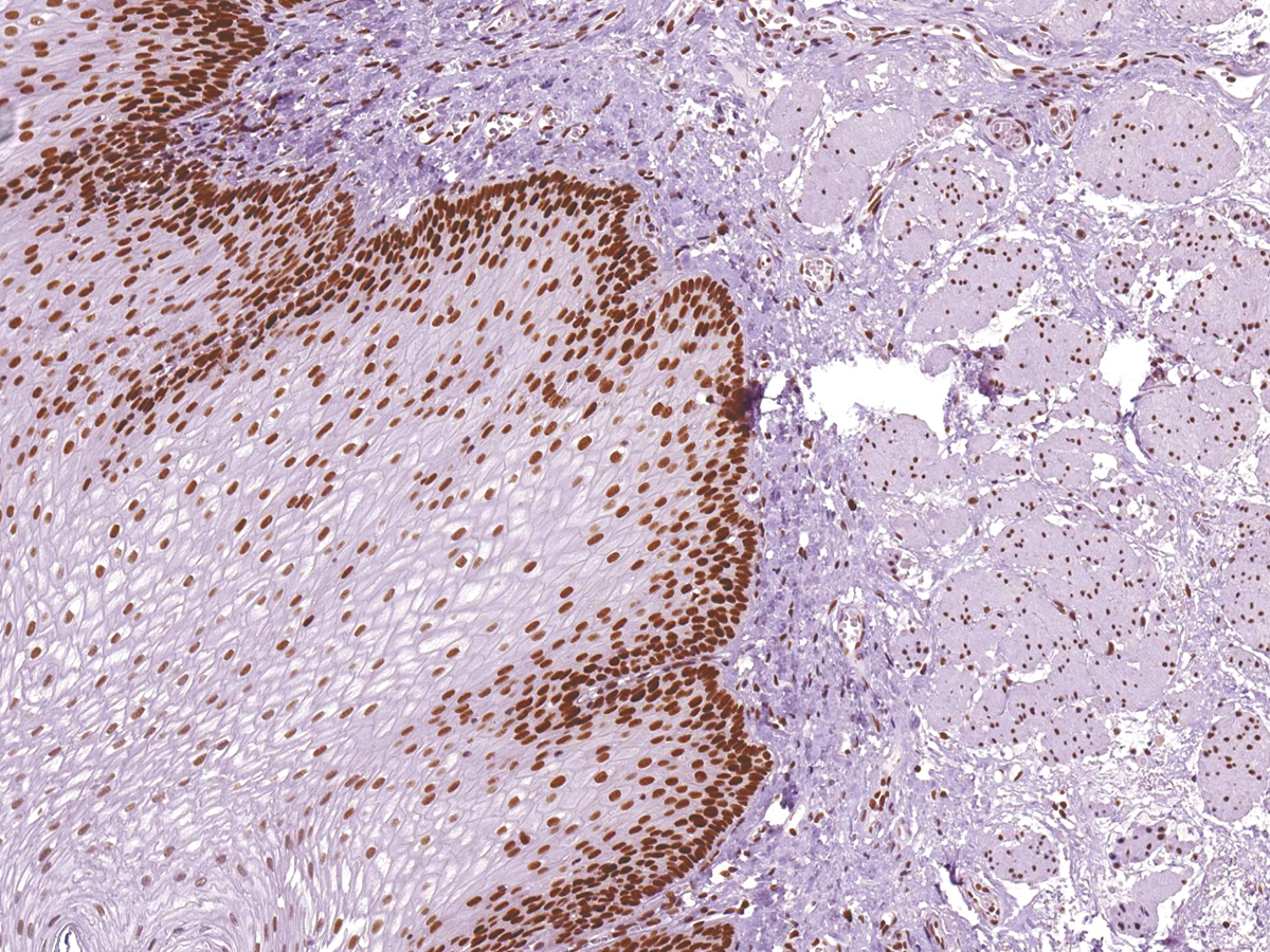 Anti-MSH6 Monoclonal Antibody (Clone:IHC006)(Discontinued)